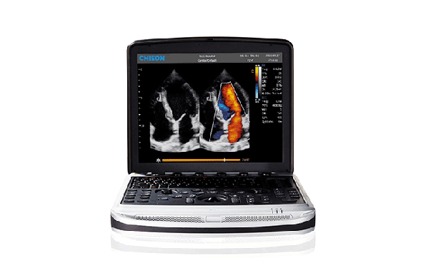 ESPECIALIZADA TRANSDUTOR CHISON SONOBOOK9 GOIAS